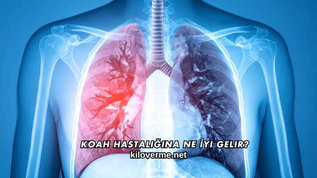 Koah Hastalığına Ne İyi Gelir?