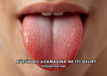 Küçük Dil Uzamasına Ne İyi Gelir?