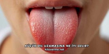 Küçük Dil Uzamasına Ne İyi Gelir?