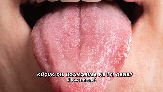 Küçük Dil Uzamasına Ne İyi Gelir?