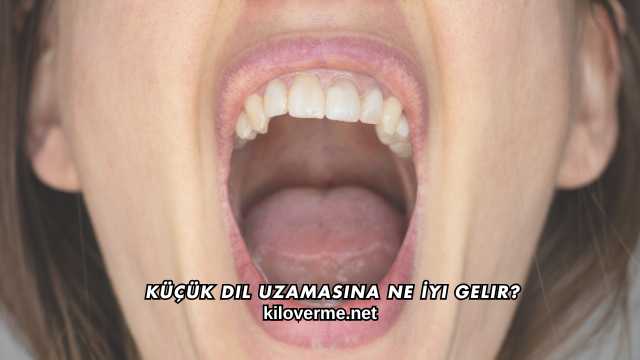 Küçük Dil Uzamasına Ne İyi Gelir?