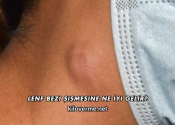 Lenf Bezi Şişmesine Ne İyi Gelir?