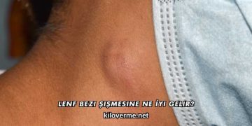 Lenf Bezi Şişmesine Ne İyi Gelir?