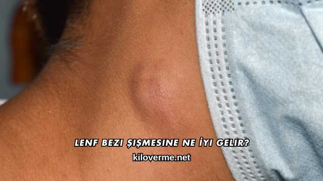 Lenf Bezi Şişmesine Ne İyi Gelir?