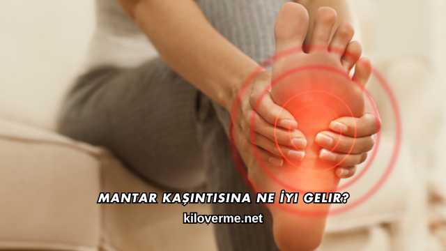 Mantar Kaşıntısına Ne İyi Gelir?