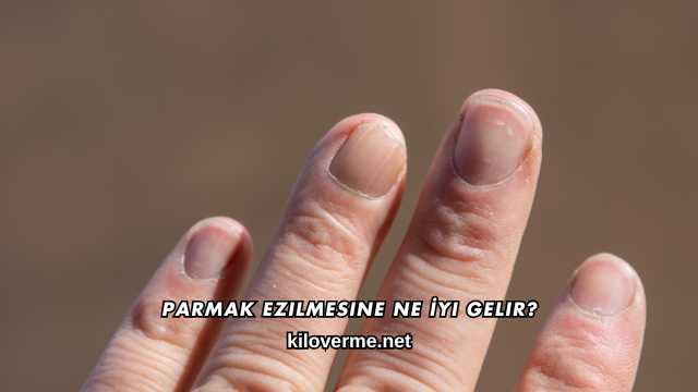 Parmak Ezilmesine Ne İyi Gelir?