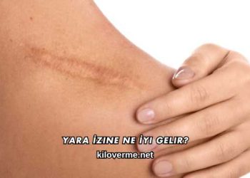 Yara İzine Ne İyi Gelir?