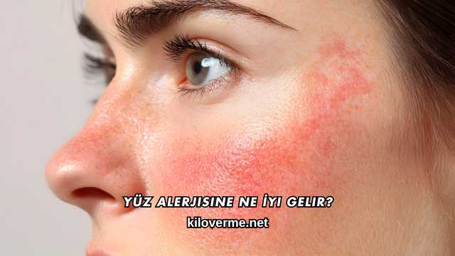 Yüz Alerjisine Ne İyi Gelir?