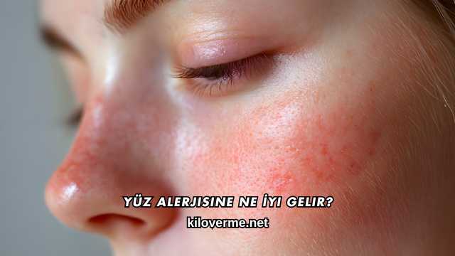 Yüz Alerjisine Ne İyi Gelir?
