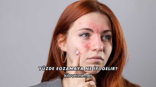 Yüzde Egzamaya Ne İyi Gelir?