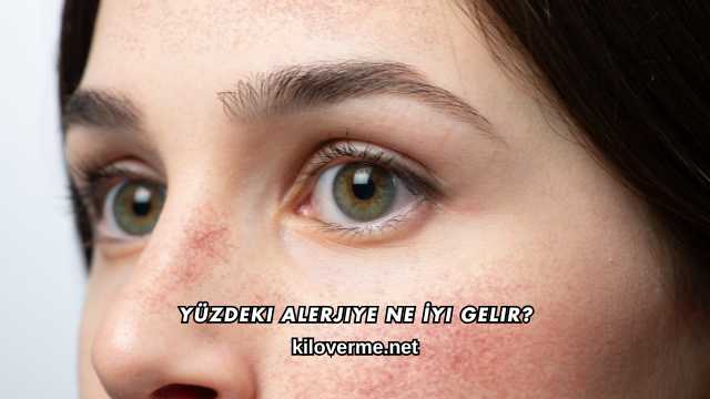 Yüzdeki Alerjiye Ne İyi Gelir?