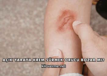 Açık Yaraya Krem Sürmek Orucu Bozar mı?