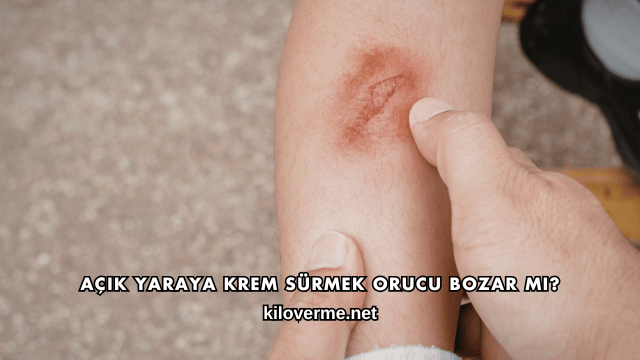 Açık Yaraya Krem Sürmek Orucu Bozar mı?