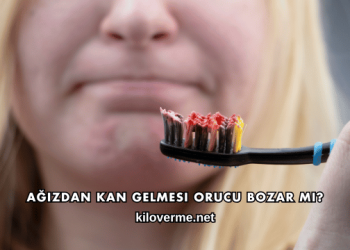 Ağızdan Kan Gelmesi Orucu Bozar mı?