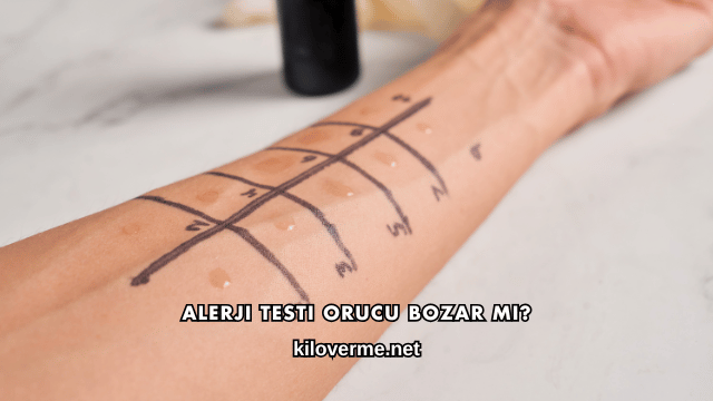 Alerji Testi Orucu Bozar mı?