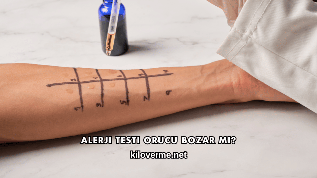Alerji Testi Orucu Bozar mı?