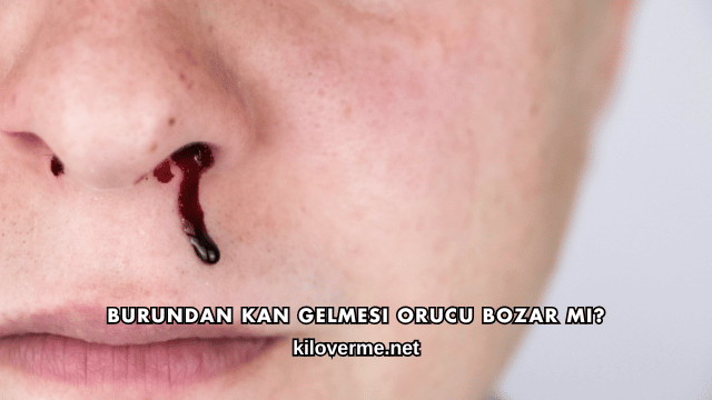 Burundan Kan Gelmesi Orucu Bozar mı