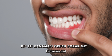Diş Eti Kanaması Orucu Bozar mı?