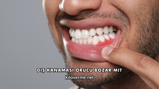 Diş Kanaması Orucu Bozar mı?