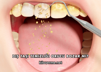Diş Taşı Temizliği Orucu Bozar mı?