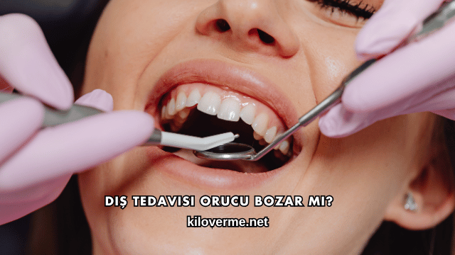 Diş Tedavisi Orucu Bozar mı?