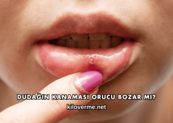 Dudağın Kanaması Orucu Bozar mı?