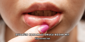 Dudağın Kanaması Orucu Bozar mı?