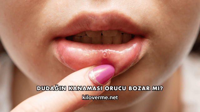 Dudağın Kanaması Orucu Bozar mı?