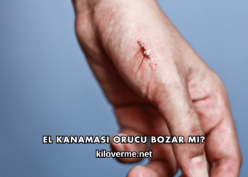 El Kanaması Orucu Bozar mı?