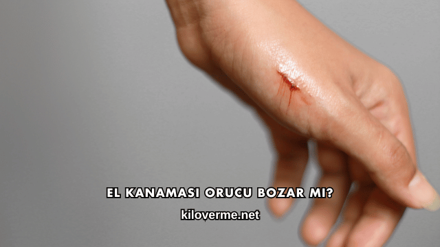 El Kanaması Orucu Bozar mı?