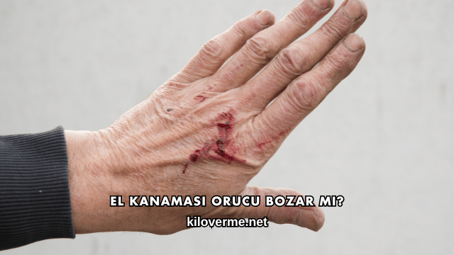 El Kanaması Orucu Bozar mı?