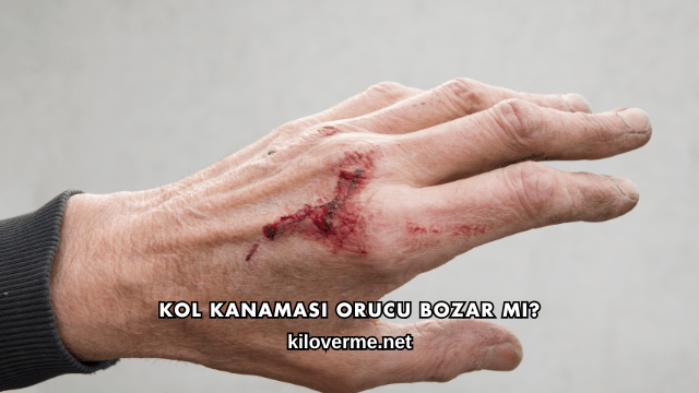 Kol Kanaması Orucu Bozar mı?