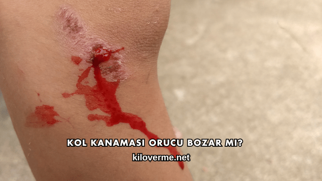 Kol Kanaması Orucu Bozar mı?