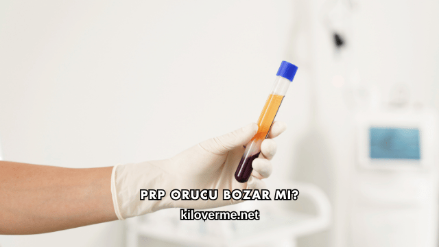 Prp Orucu Bozar mı