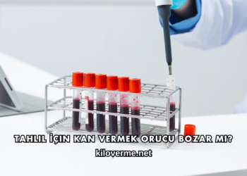 Tahlil İçin Kan Vermek Orucu Bozar mı?